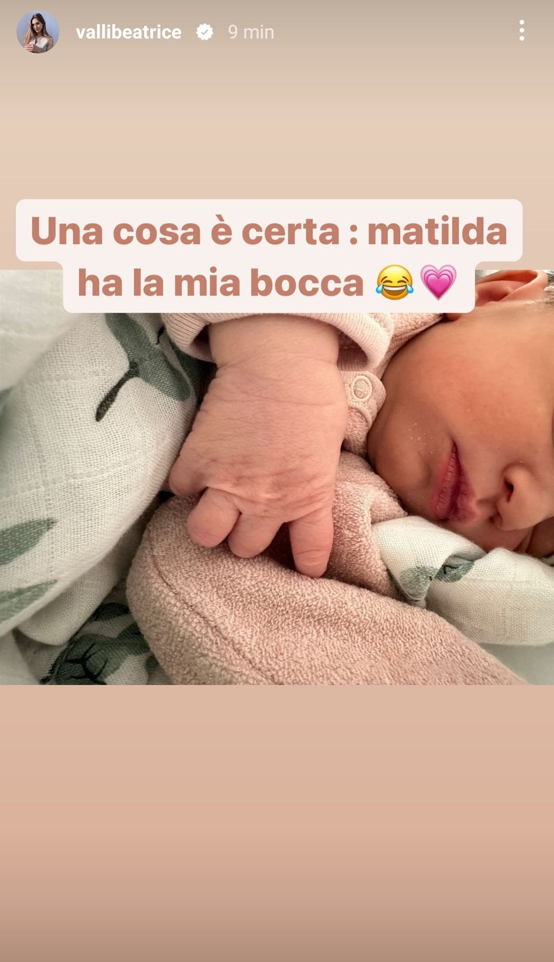 Beatrice Valli mostra alcuni dettagli del viso di Matilda Luce. Fonte: vallibeatrice - Instagram
