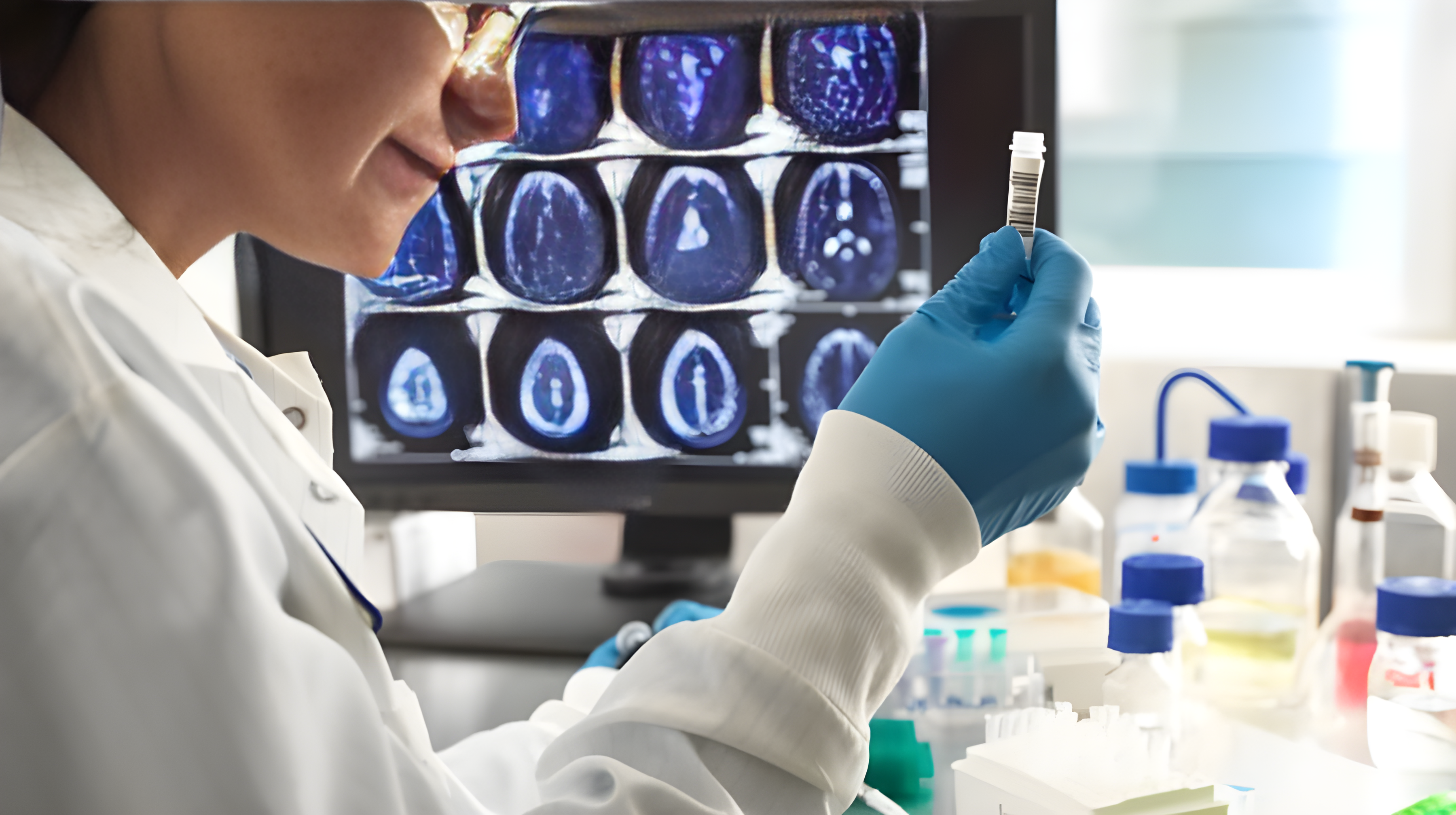 Vaccini: grandi novità per la lotta all'Alzheimer