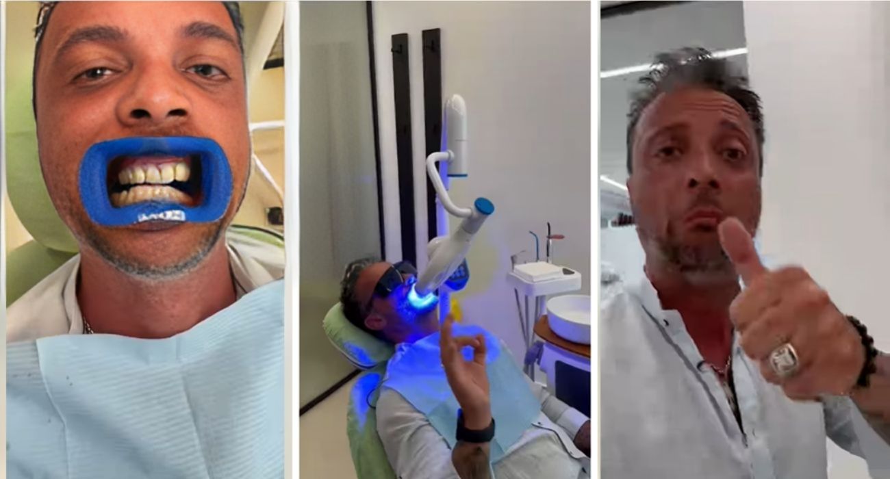 Albania, italiano va in una clinica dentale e rivela: "Quanto ho pagato per pulizia e sbiancamento dei denti"