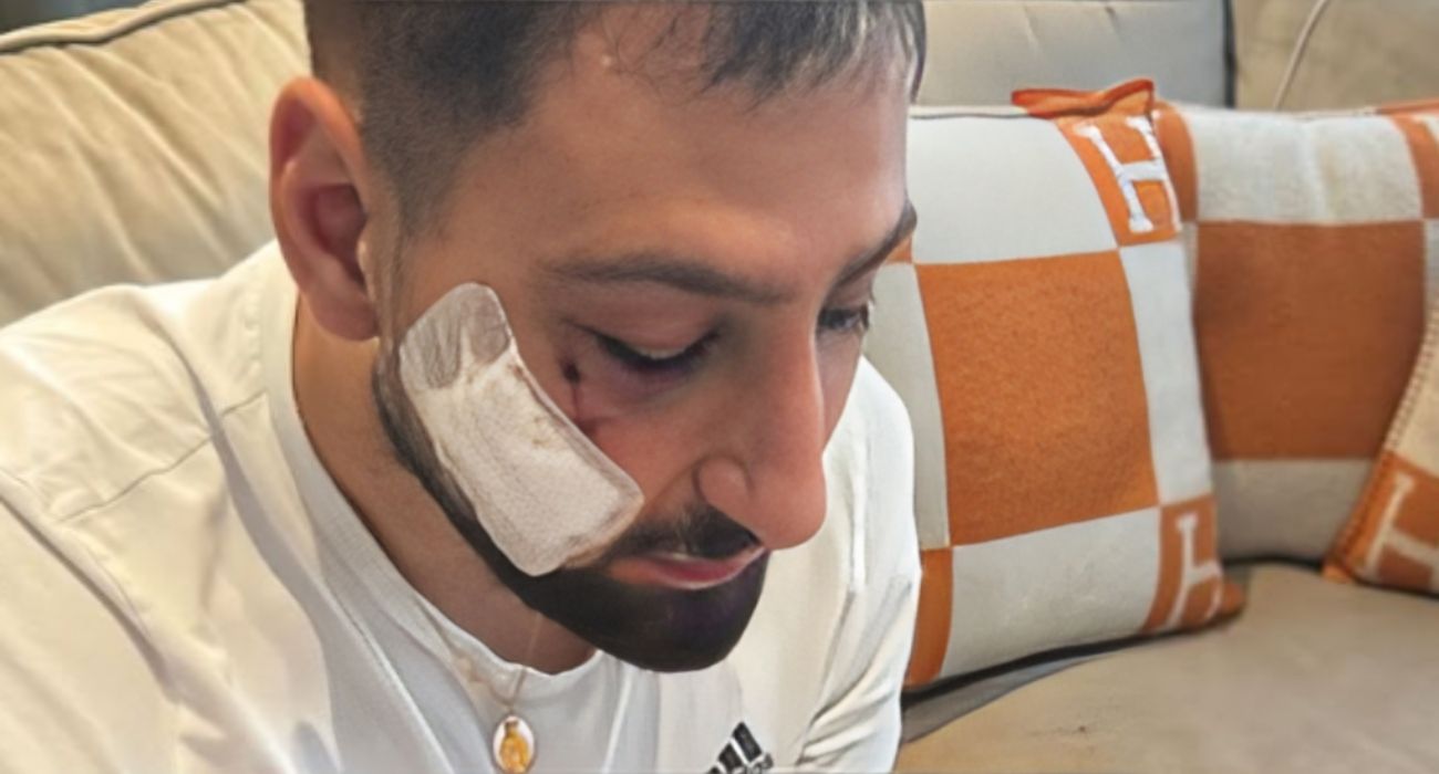 Gianluigi Donnarumma (1)