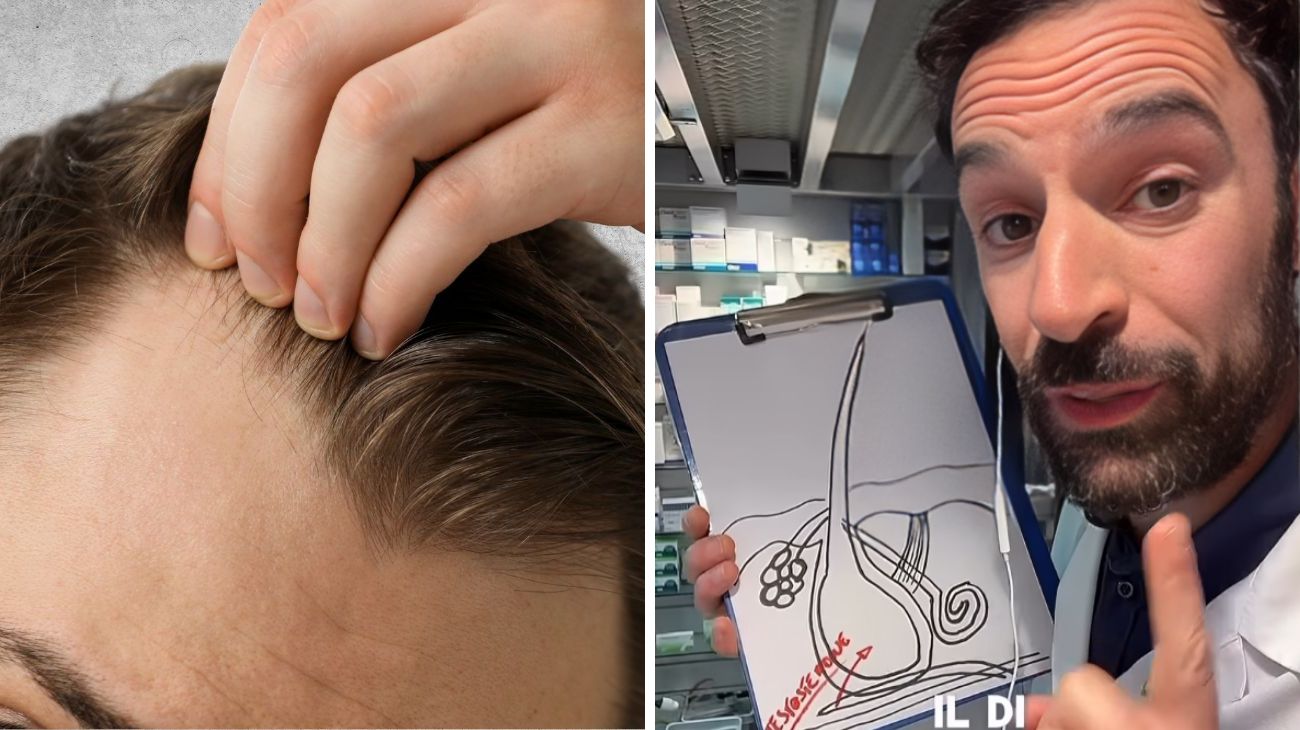 caduta dei capelli