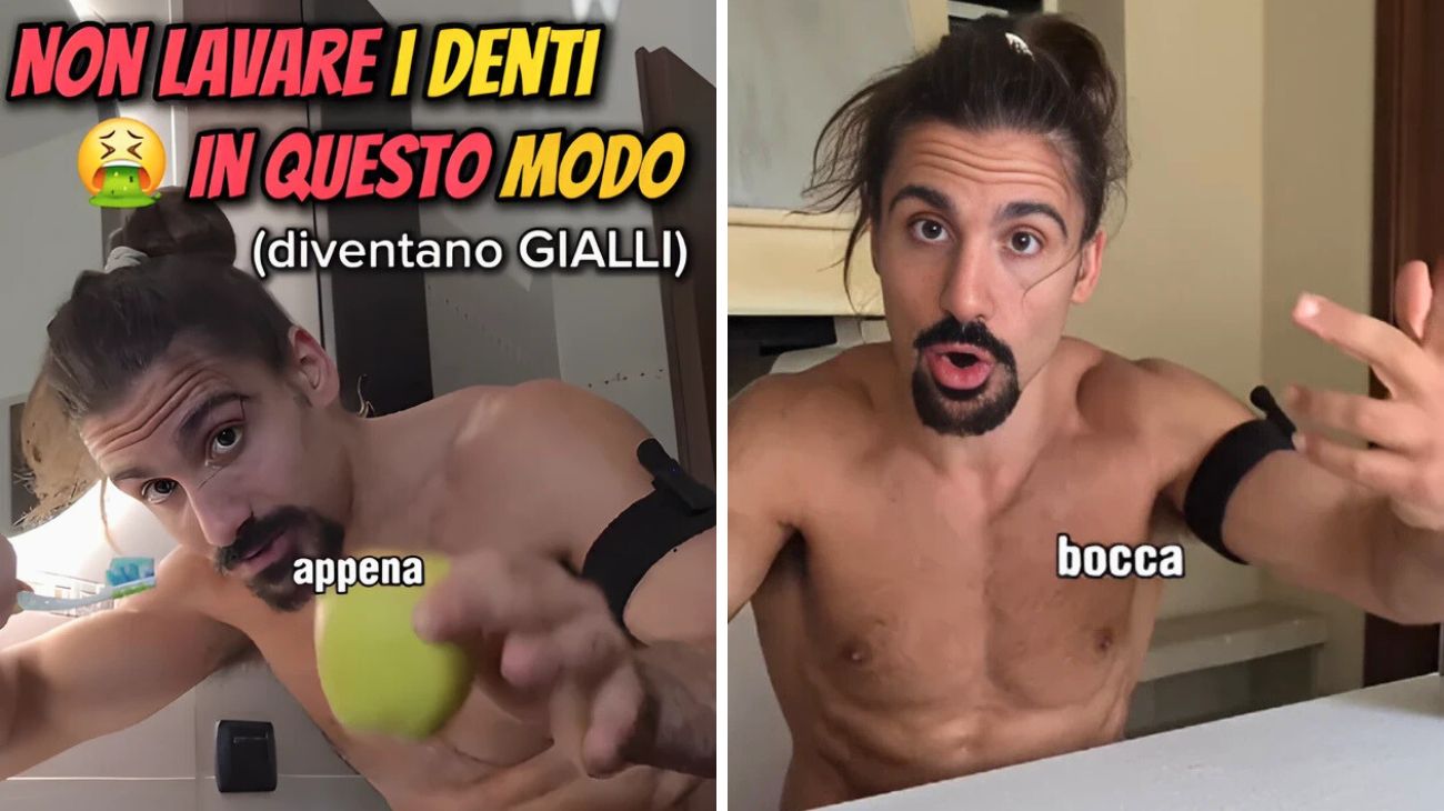 Denti gialli