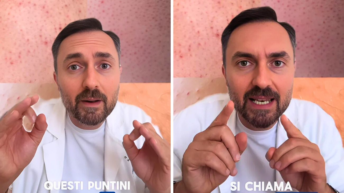 Puntini ruvidi braccia