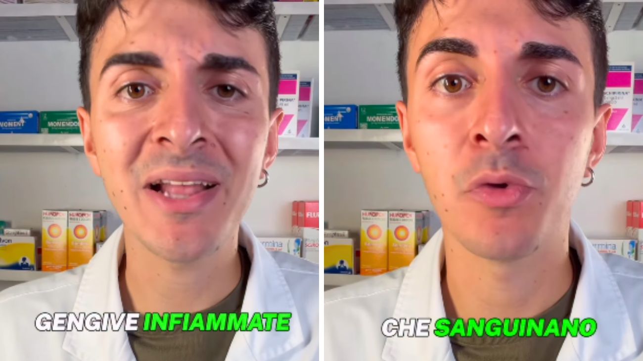 Alitosi e gengive infiammate
