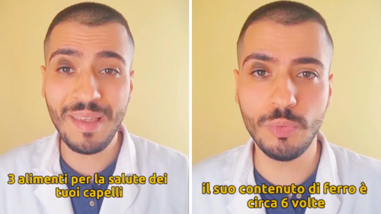 Capelli alopecia