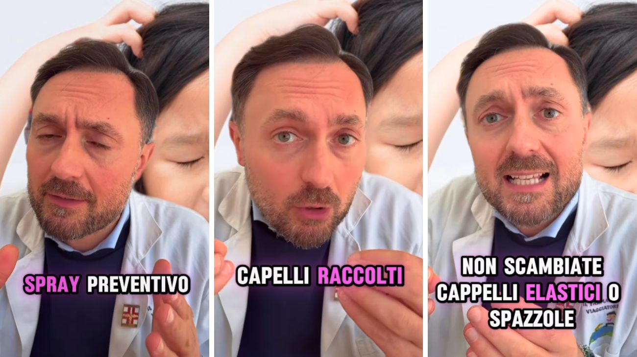 Pidocchi nei bambini